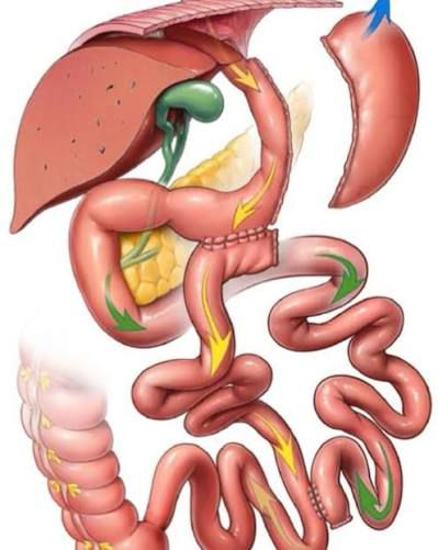 SANTORO BIPARTITION